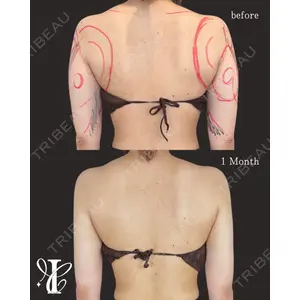 IANA CLINIC 穴井 元康医師の症例