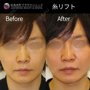 紀尾井町プラザクリニック 平井 春那医師の症例