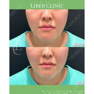 LIBER CLINICの症例