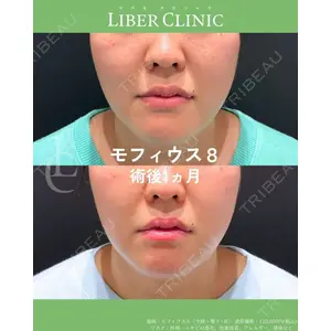 LIBER CLINICの症例