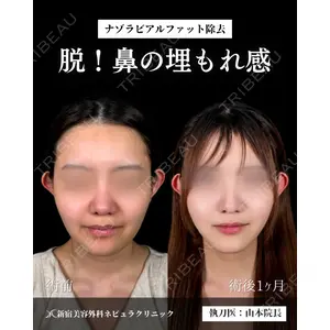 新宿美容外科ネビュラクリニック 山本 紘子医師の症例