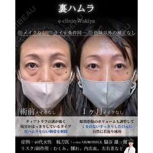 eクリニック 大阪梅田 西日本統括院 脇谷 雄一朗医師の症例