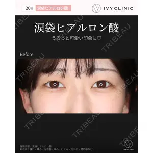 吉祥寺アイビークリニック 巴 窓花医師の症例