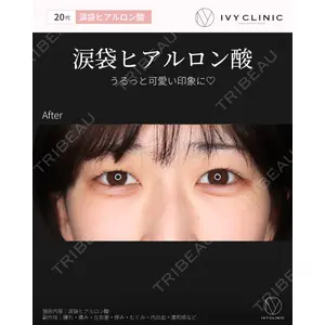 吉祥寺アイビークリニック 巴 窓花医師の症例