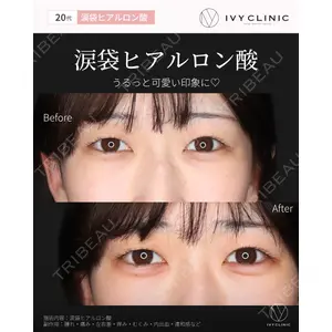 吉祥寺アイビークリニック 巴 窓花医師の症例