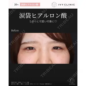 吉祥寺アイビークリニック 巴 窓花医師の症例