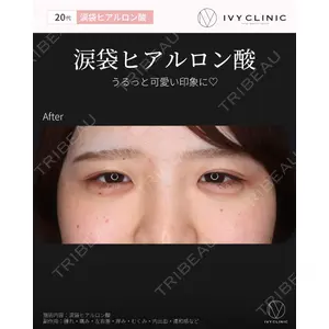 吉祥寺アイビークリニック 巴 窓花医師の症例