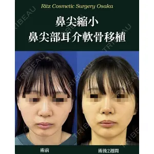 リッツ美容外科 大阪院 志賀　由章医師の症例
