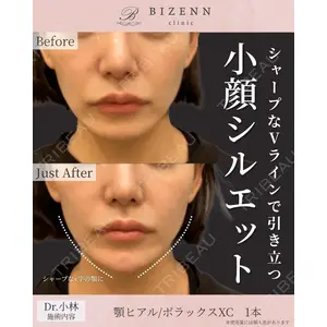 BIZENNクリニック【ビゼンクリニック】 小林 泰俊医師の症例