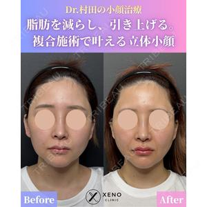 ゼノクリニック 村田 大典医師の症例