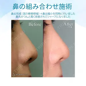 聖心美容クリニック 札幌院の症例