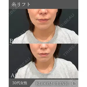 ブルームクリニック（BLOOM CLINIC）の症例