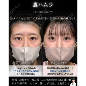 eクリニック 大阪梅田 西日本統括院 脇谷 雄一朗医師の症例