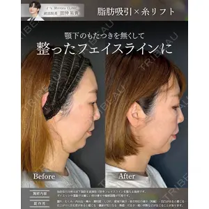 Mirrora CLINIC 田仲 祐貴医師の症例