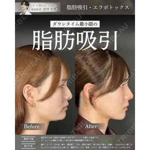Mirrora CLINIC 田仲 祐貴医師の症例