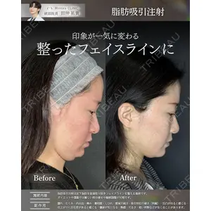 Mirrora CLINIC 田仲 祐貴医師の症例