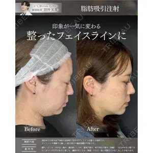 Mirrora CLINIC 田仲 祐貴医師の症例