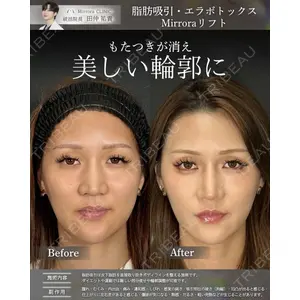 Mirrora CLINIC 田仲 祐貴医師の症例