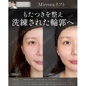 Mirrora CLINIC 田仲 祐貴医師の症例