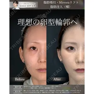 Mirrora CLINIC 田仲 祐貴医師の症例