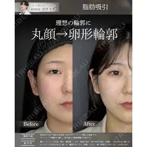 Mirrora CLINIC 田仲 祐貴医師の症例