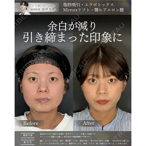Mirrora CLINIC 田仲 祐貴医師の症例