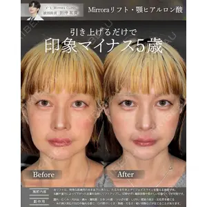 Mirrora CLINIC 田仲 祐貴医師の症例
