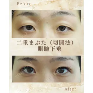 郡山タウン形成外科クリニック 石原 信浩医師の症例