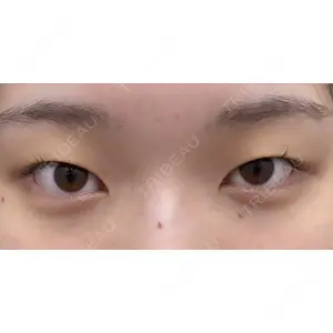 湘南美容クリニック 渋谷院 宮城　幸平医師の症例