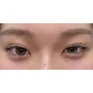 湘南美容クリニック 渋谷院 宮城　幸平医師の症例