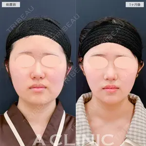 A CLINIC（エークリニック） 福岡院の症例