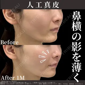 EMMO FACE CLINIC 東京三田院 木之下 哲彦医師の症例