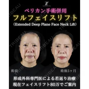 Zetith Beauty Clinic 新宿院 副島直人医師の症例