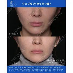 Zetith Beauty Clinic 新宿院 新井佑梨医師の症例