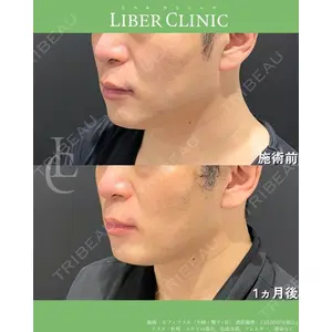 LIBER CLINIC 矢橋 洋一郎医師の症例