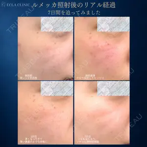 ECLA CLINIC (エクラクリニック) 緒方 善孝医師の症例