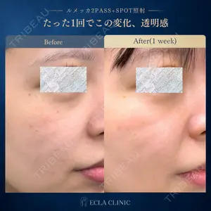ECLA CLINIC (エクラクリニック) 緒方 善孝医師の症例