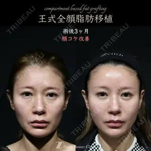 Zetith Beauty Clinic 新宿院 王 蘇医師の症例