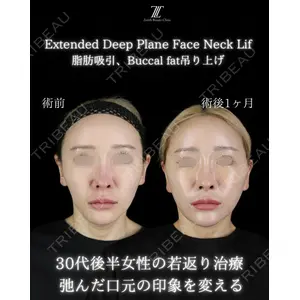Zetith Beauty Clinic 新宿院 副島直人医師の症例