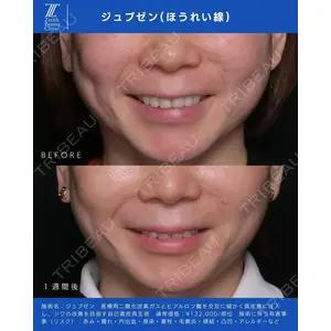 Zetith Beauty Clinic 新宿院 新井佑梨医師の症例