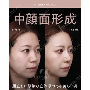 コントアクリニック 東京 石川 菜緒医師の症例