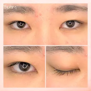 東京BELLEZZAクリニックの症例