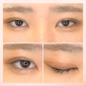 東京BELLEZZAクリニックの症例