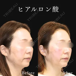 東京ココセランクリニック 小野田 豪医師の症例
