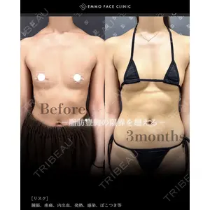 EMMO FACE CLINIC 大阪梅田院 松本洋麻医師の症例