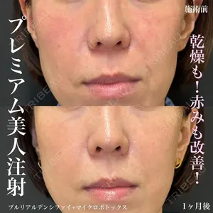 ルラ美容クリニック 名古屋栄院 / ルラスキンクリニック 名古屋栄院 関戸 優医師の症例