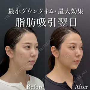 湘南美容クリニック 渋谷院 小草 智之医師の症例
