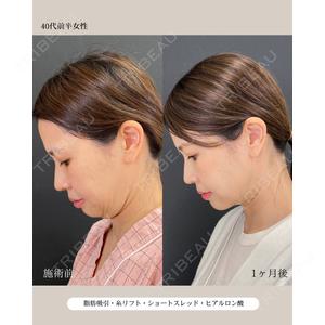 自由が丘ウェルエイジングビューティークリニック 福田 知佐子医師の症例