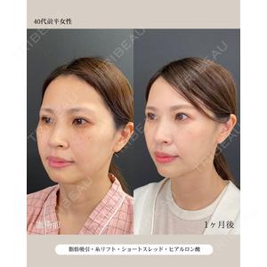 自由が丘ウェルエイジングビューティークリニック 福田 知佐子医師の症例
