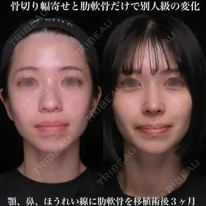Zetith Beauty Clinic 銀座院 鉄 鑠医師の症例